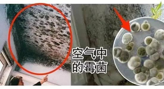 印度疫情拖垮全世界:恐怖“黑木耳病”开始流行,上万人摘眼求生