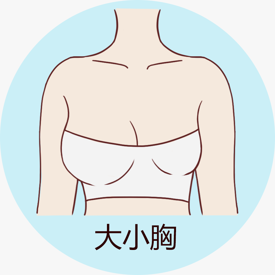「九院韦敏教授」胸部大小不一样是否可以隆胸改善？