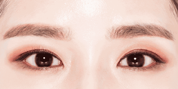 什么样的眼睛适合做全切双眼皮？